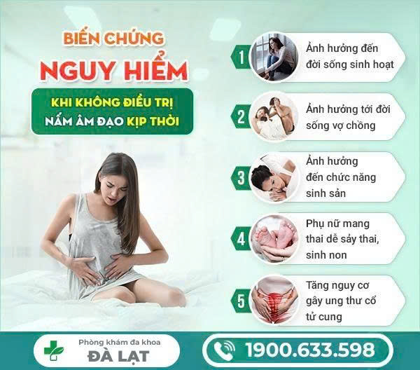 Hình ảnh minh họa